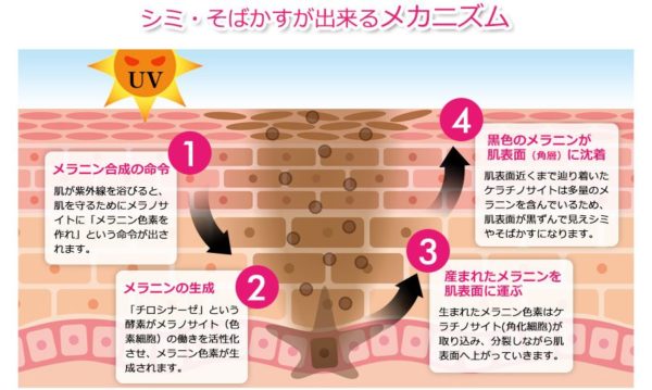 ホワイピュア薬用美白クリーム シミやそばかすの原因とメカニズム